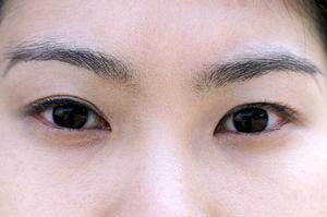 脱毛の口コミを取り扱っているサイト